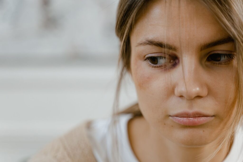 NASPI e violenza di genere pexels-mart-production-7699531